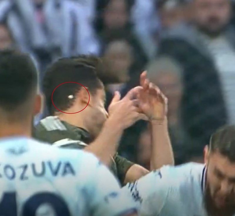 Beşiktaş'ta Gabriel Paulista'nın dişi kırıldı!- Beşiktaş