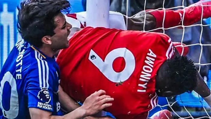 Yıldız oyuncu ameliyattan sonra komaya girdi: Premier Lig'de korkunç sakatlık! Resmi açıklama geldi- Futbol